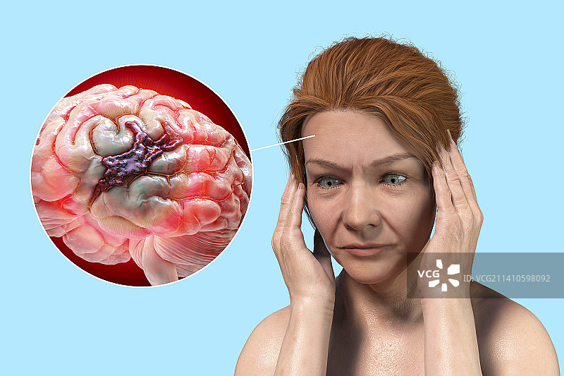 笔触插画图片素材