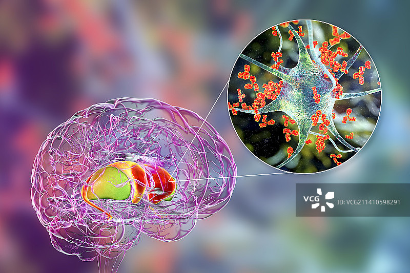 抗基底神经节抗体图示图片素材