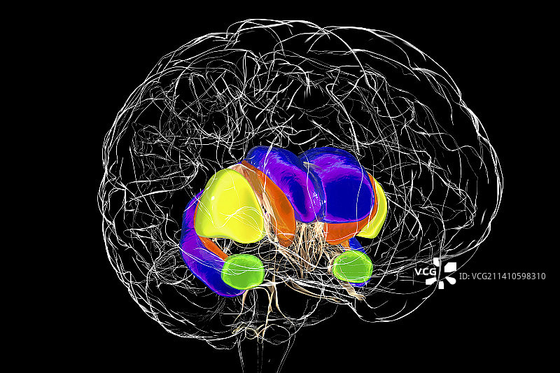 亨廷顿舞蹈症中的背侧纹状体，图示图片素材