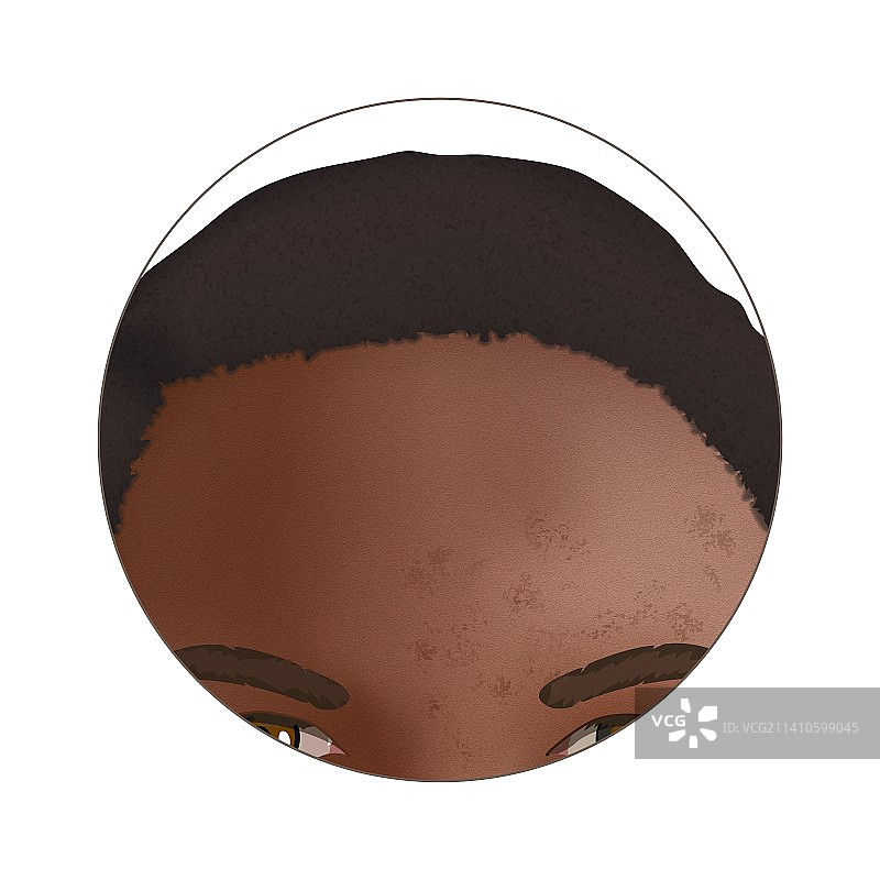 炎症后色素沉着插图图片素材