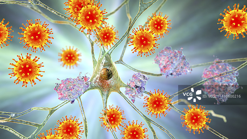 痴呆症的传染性病因概念图图片素材