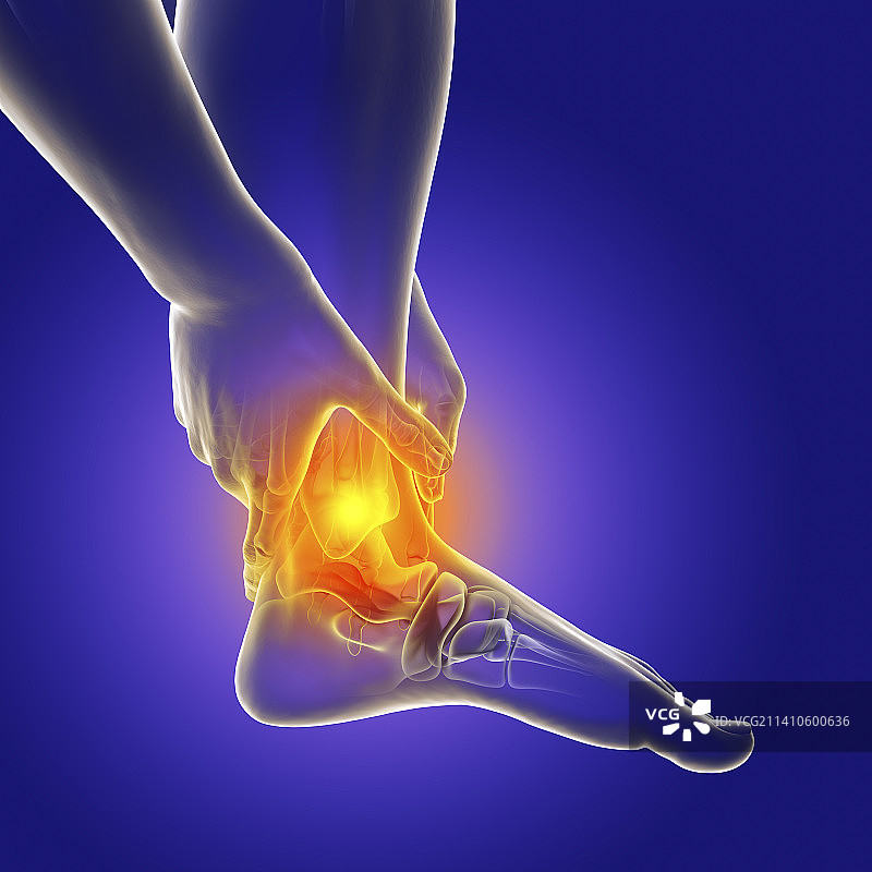 疼痛的脚踝插画图片素材