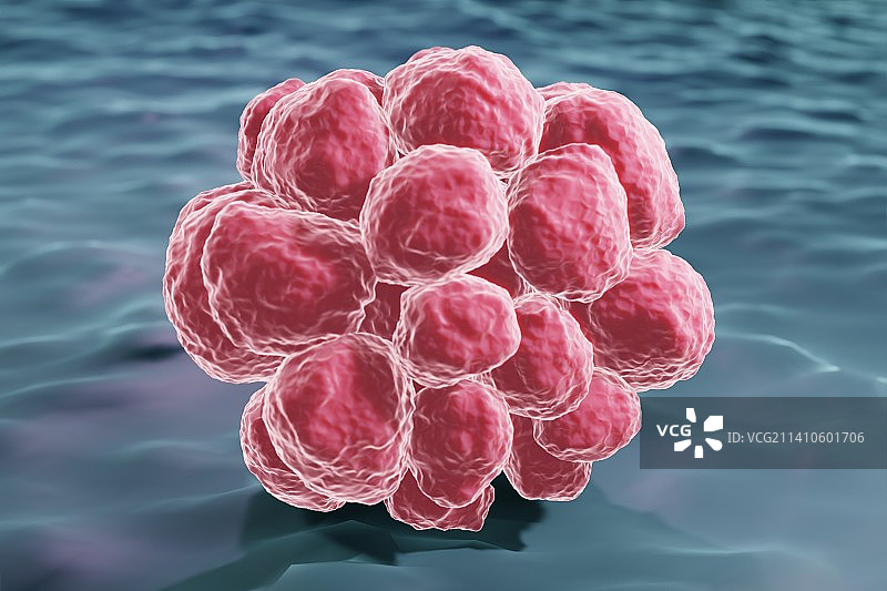 肿瘤中的癌细胞，图示图片素材