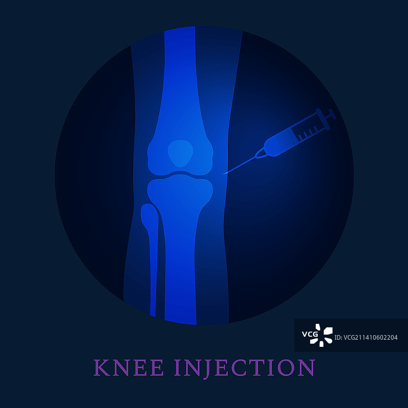 膝关节注射治疗概念图图片素材