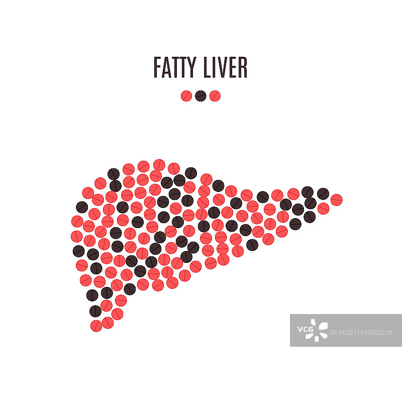 脂肪肝概念图图片素材