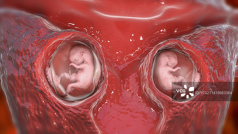 异卵双胞胎插画图片素材