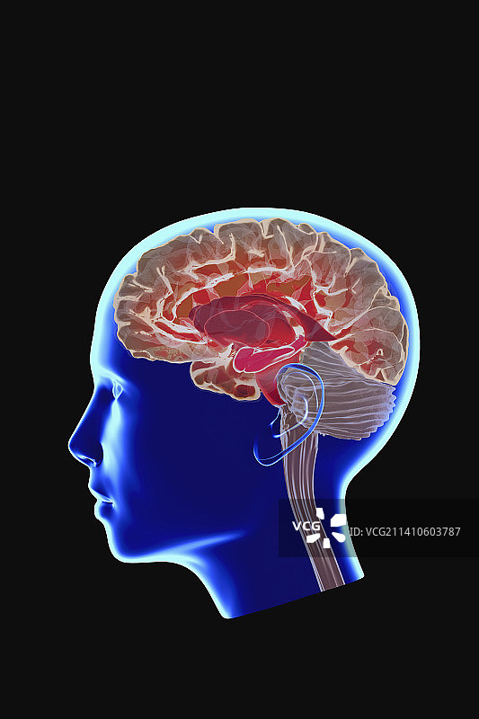 影响海马体的阿尔茨海默病图示图片素材