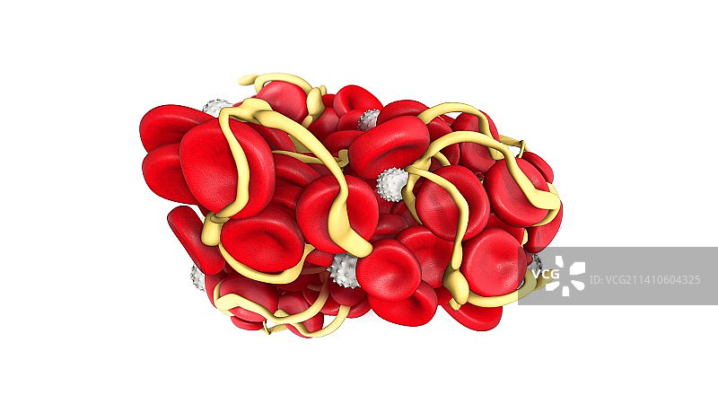 血栓图示图片素材