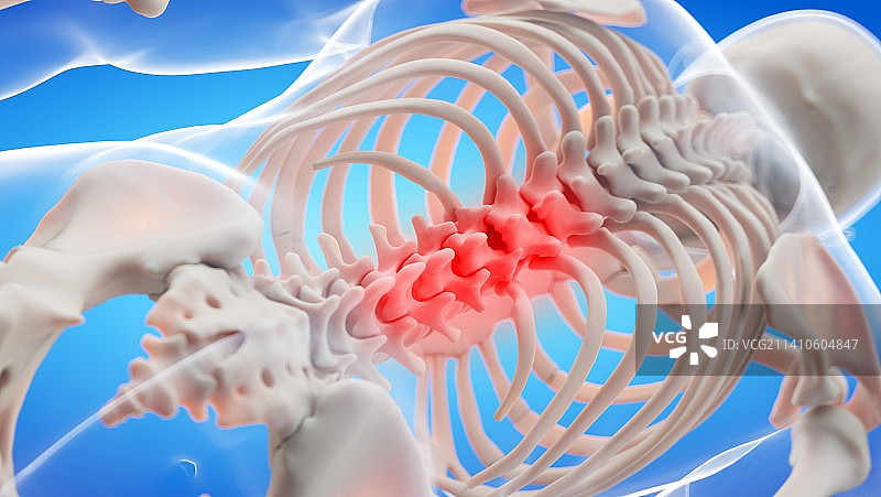 背痛插图图片素材