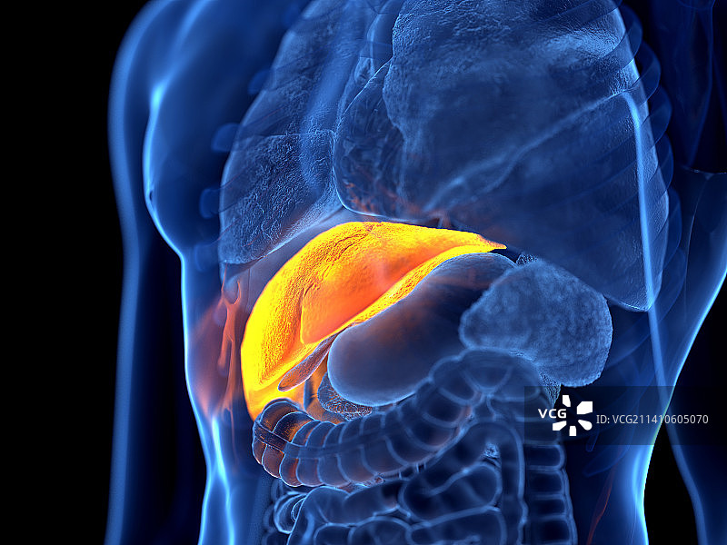 肝癌，图示图片素材
