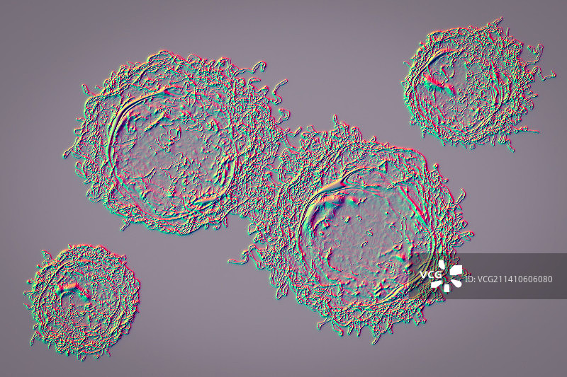 癌细胞，插图图片素材