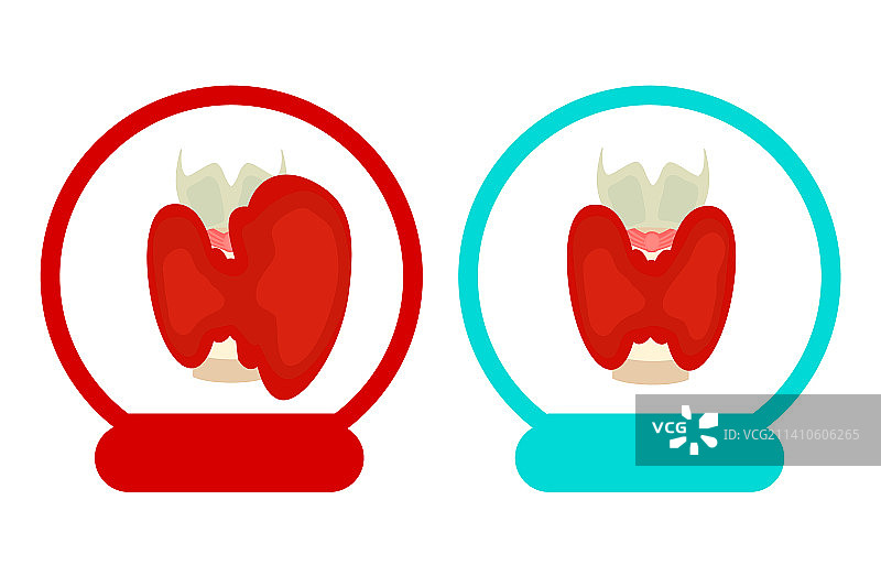 甲状腺，插图图片素材