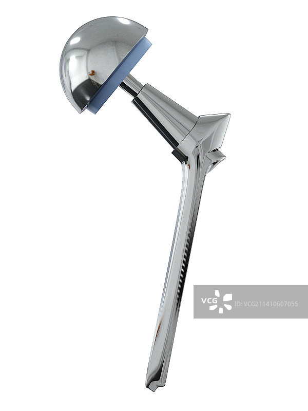 髋关节置换术插图图片素材