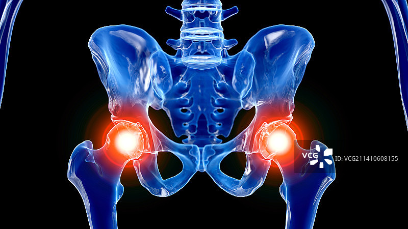 髋关节疼痛插画图片素材