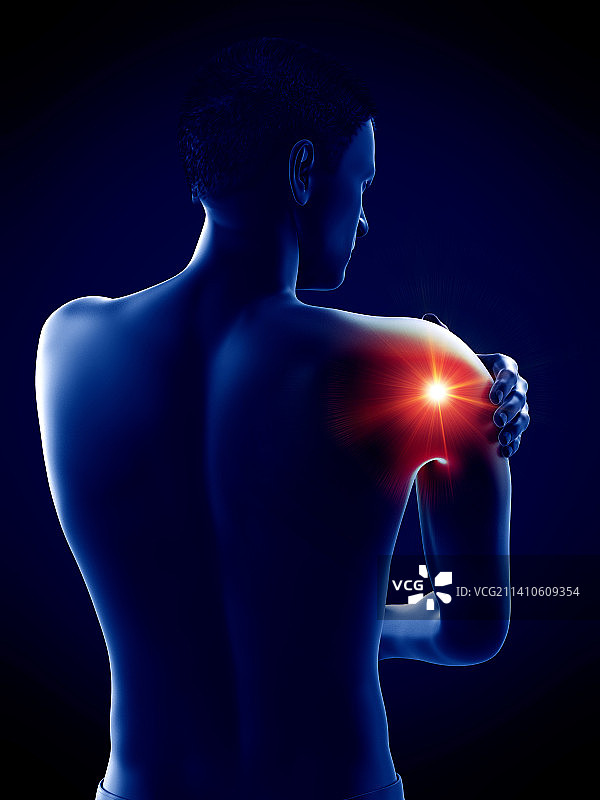 肘部疼痛插画图片素材