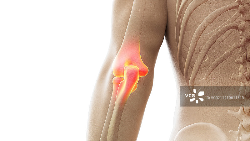 肘关节疼痛示意图图片素材