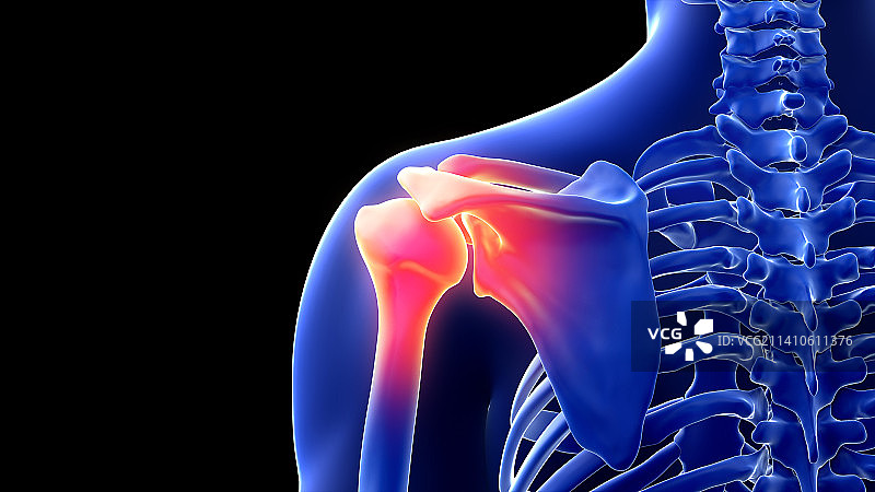 肩部疼痛插画图片素材