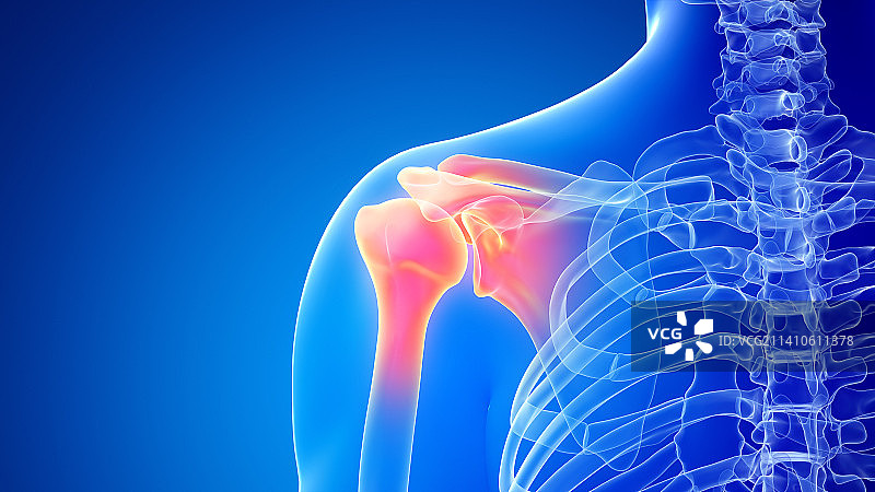 肩部疼痛插画图片素材