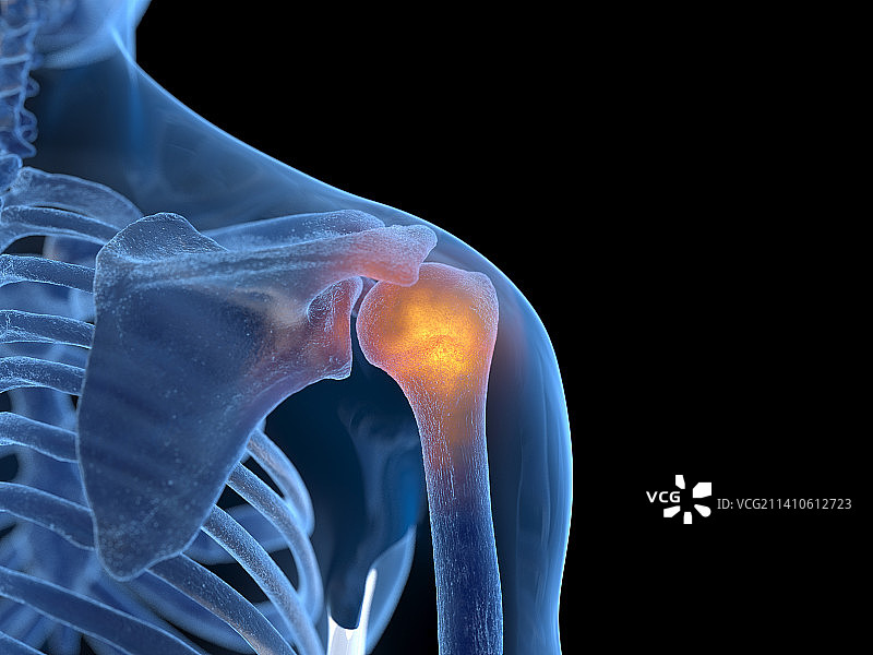 肩部疼痛插画图片素材