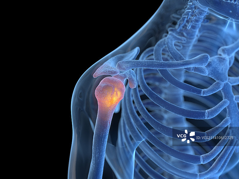 肩部疼痛插画图片素材