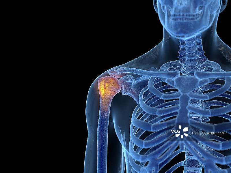 肩部疼痛插画图片素材