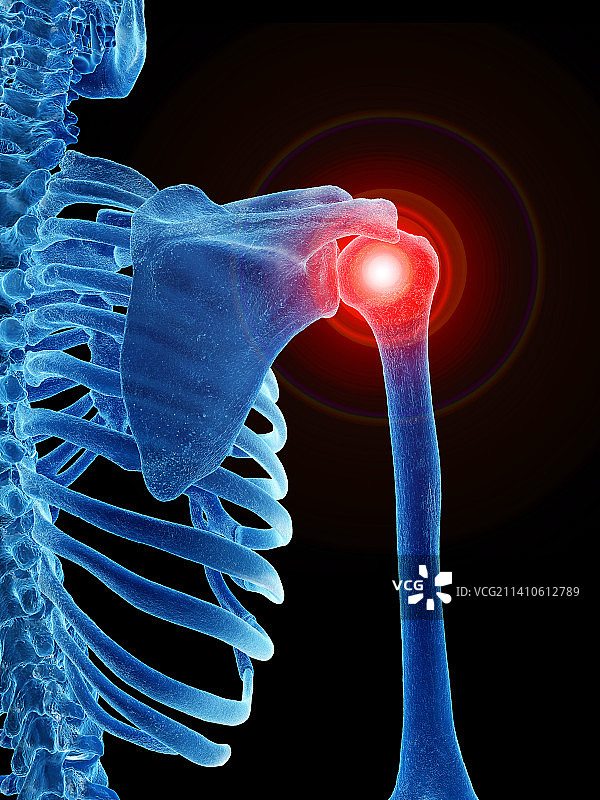 肩部疼痛插画图片素材