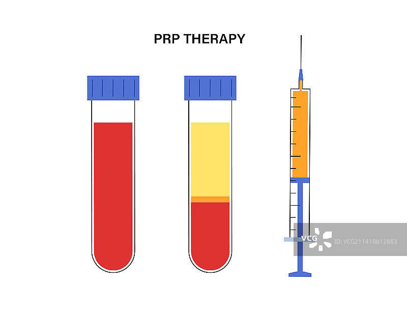 富血小板血浆疗法插画图片素材
