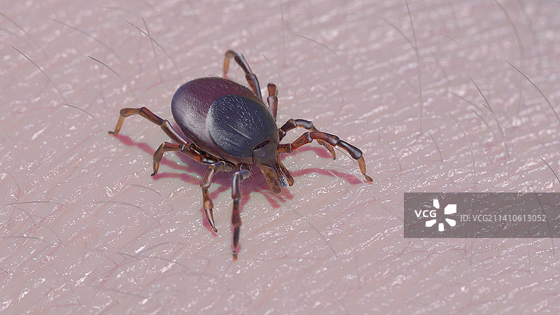 人皮肤上的蜱虫，插图图片素材