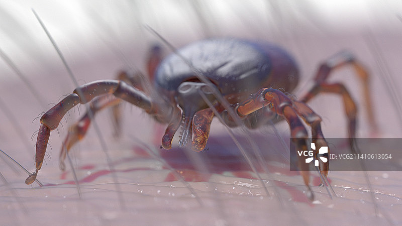 人皮肤上的蜱虫，插图图片素材