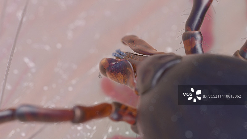 人皮肤上的蜱虫，插图图片素材