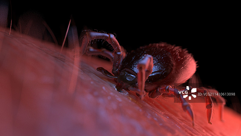 蜱虫叮咬人皮肤插图图片素材