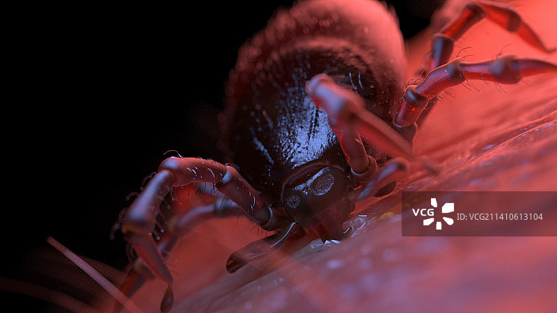 蜱虫叮咬人皮肤插图图片素材