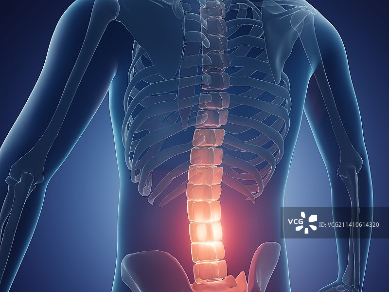 腰背疼痛图图片素材
