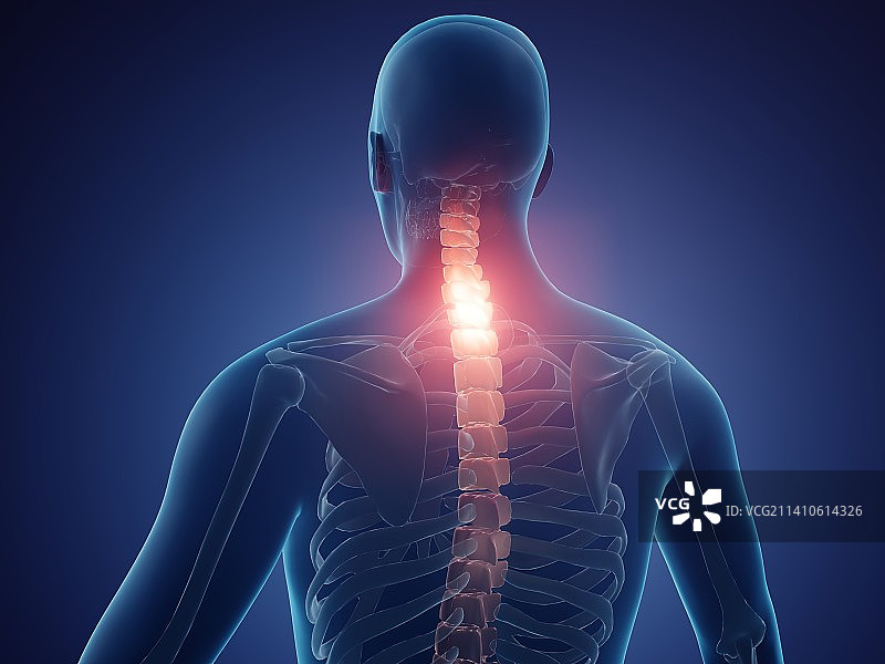 颈部疼痛插画图片素材