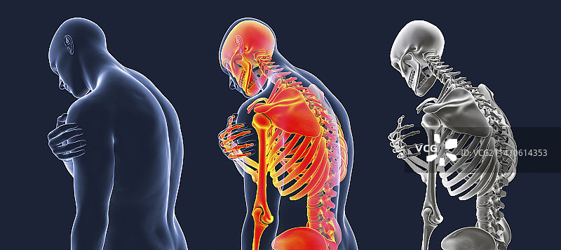 肩部疼痛插画图片素材