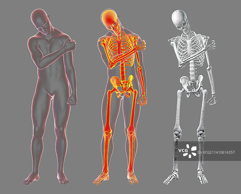 肩部疼痛插画图片素材