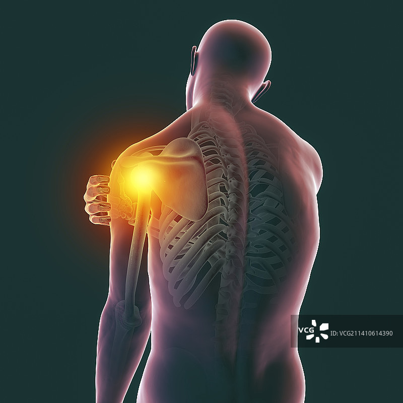 肩部疼痛插画图片素材
