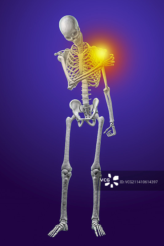 肩部疼痛插画图片素材