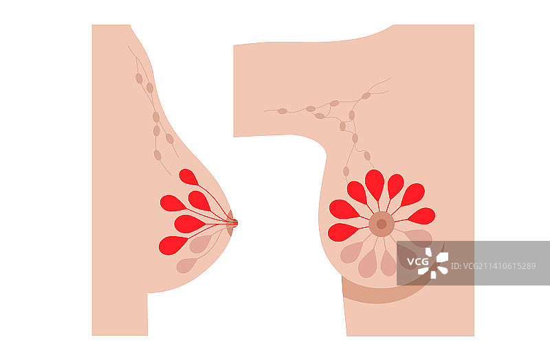 乳腺炎插图图片素材