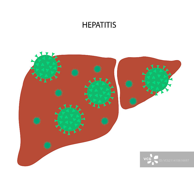 肝脏疾病插图图片素材