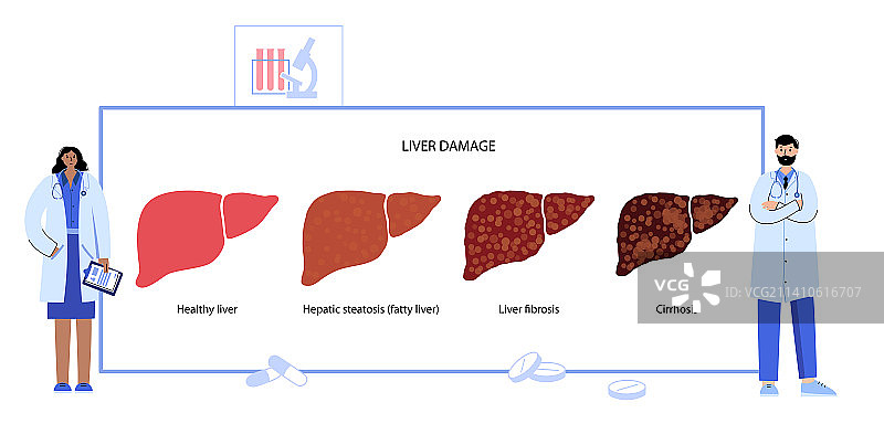 肝脏疾病插图图片素材