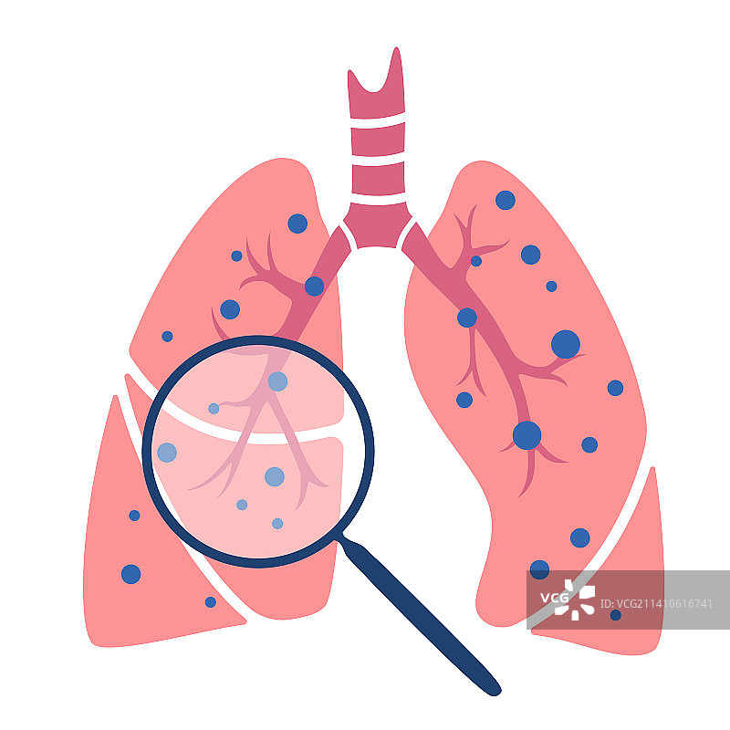 肺部疾病概念图图片素材