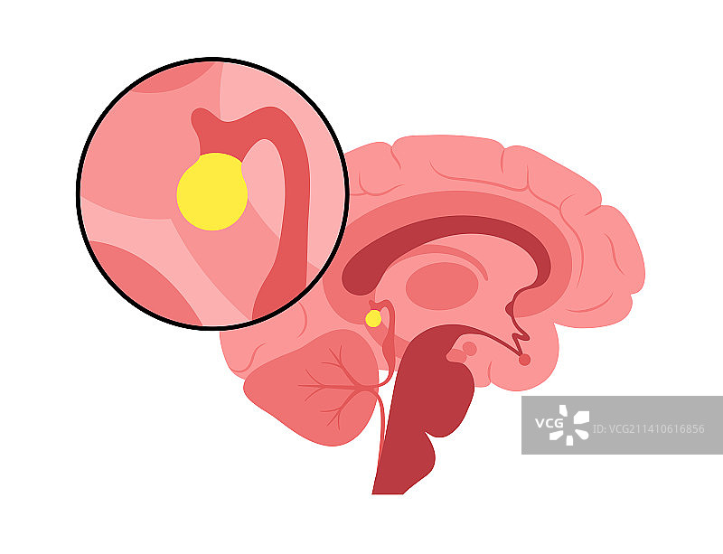 松果体插图图片素材