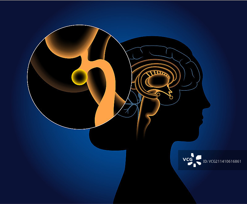 松果体插图图片素材