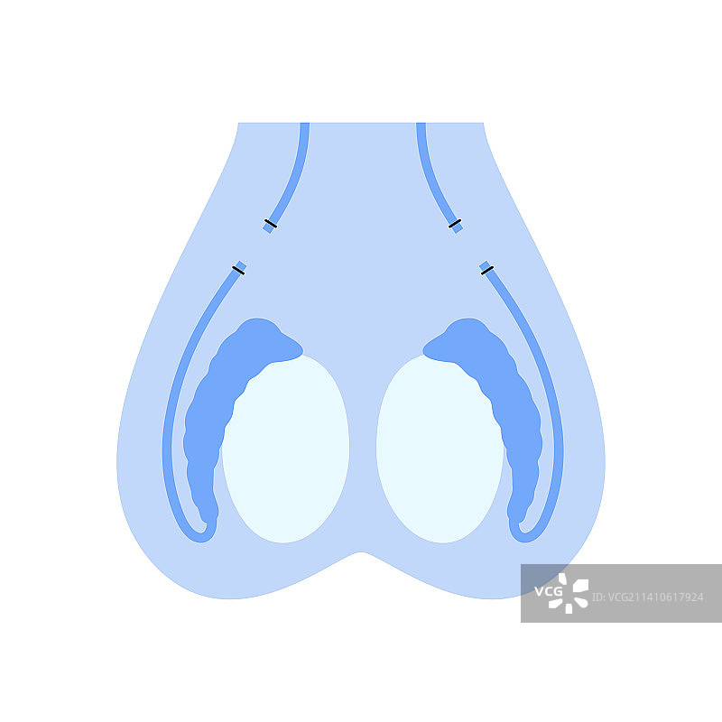 输精管结扎术图示图片素材