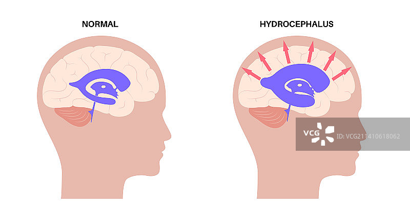 脑室系统图示图片素材