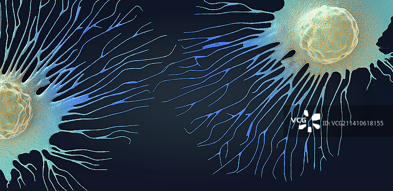 扩散的癌细胞，图示图片素材