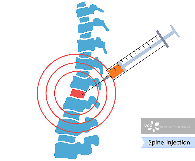脊柱注射插图图片素材