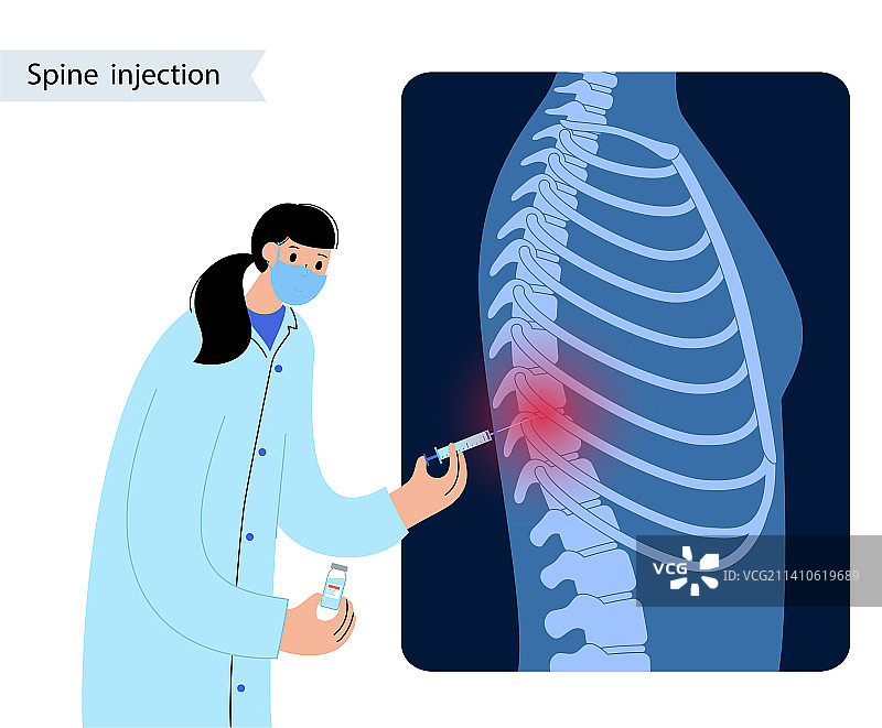 脊柱注射插图图片素材