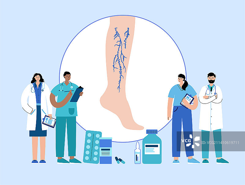 静脉曲张治疗图示图片素材